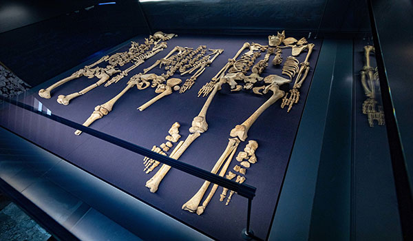 "Medieval Mile Museum Human Remains Exhibition"